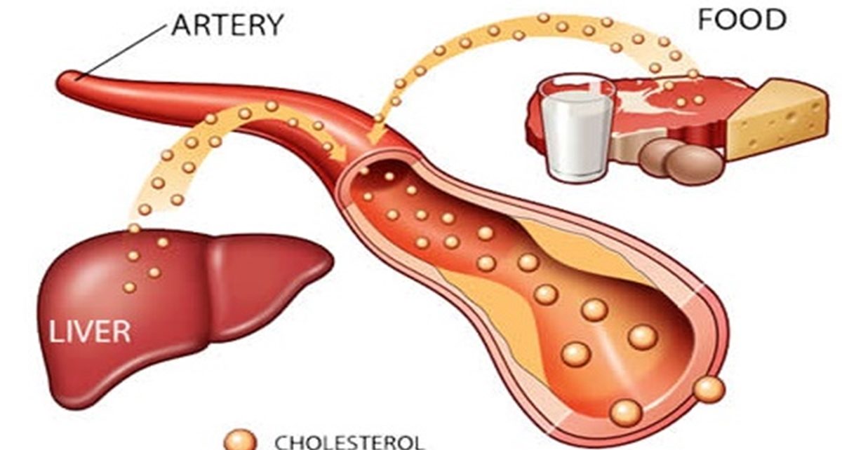 5 Cara Mudah Menurunkan LDL, Si "Kolesterol Jahat" Biang Penyakit